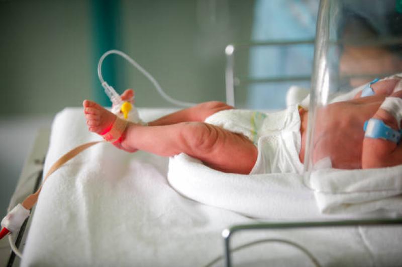 Dokter Anak Mengungkap Alasan Bayi Prematur Rentan Mengalami Stunting