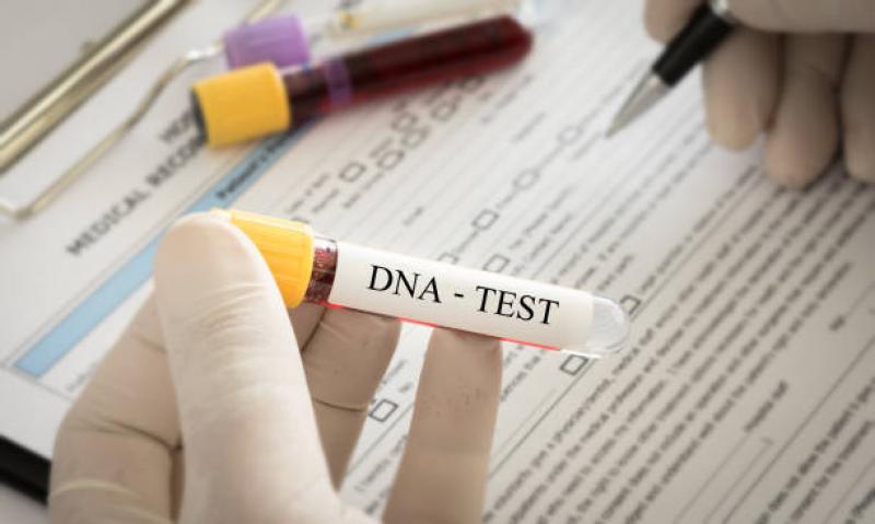 Ketahui Beragam Jenis dan Manfaat dari Test DNA