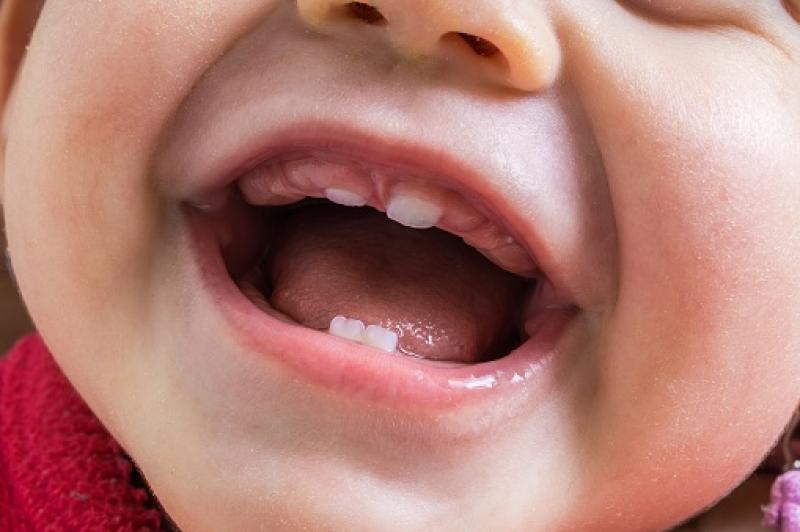 Ketika Bayi Tumbuh Gigi, Kesulitan Tidur Malam Bisa Terjadi: Temukan 7 Cara Mengatasinya