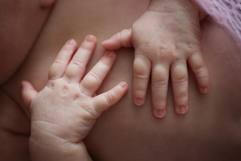 Mengapa Kulit Bayi Baru Lahir Dapat Mengalami Perubahan Warna?