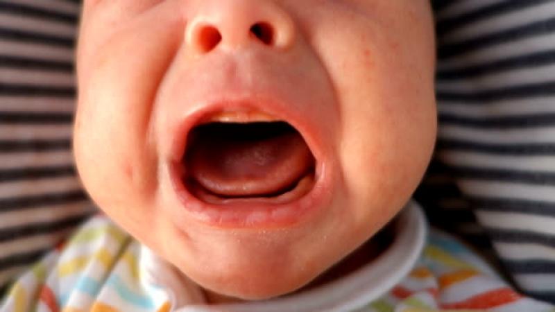 Pentingnya Tangisan Pertama Bayi yang Baru Lahir, Sebagai Indikator Kesehatan Paru-parunya