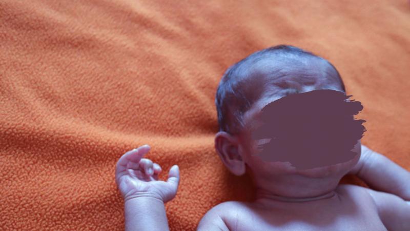 Sianosis pada Bayi: Tanda, Penyebab, Pencegahan, dan Cara Pengobatannya